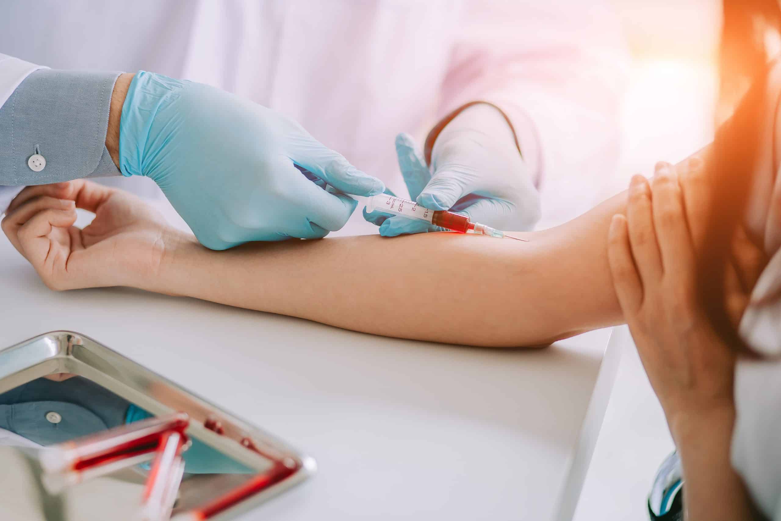 Ayuno y Análisis de Sangre: Por Qué es Necesario y Cómo Prepararse