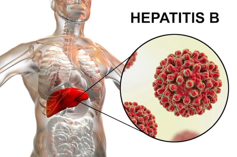 Diagnóstico de Hepatitis B: Pruebas para Detectar la Infección