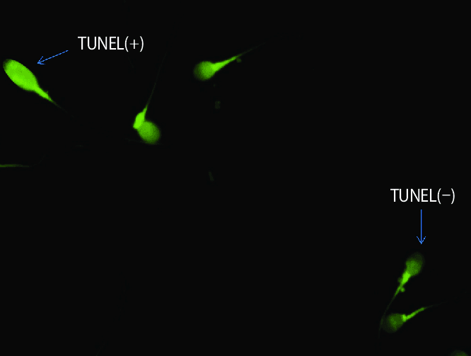 Test de TUNEL: Su Impacto en la Fertilidad Masculina