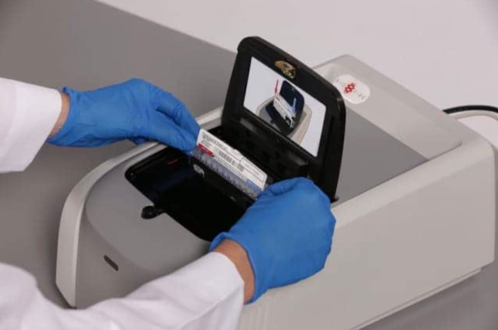 Diagnóstico Molecular de Enfermedades Infecciosas con FilmArray: Precisión y Rapidez en la Detección de Patógenos